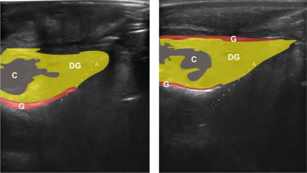 Two ultrasound images displaying red abalone reproductive organs among other organs.